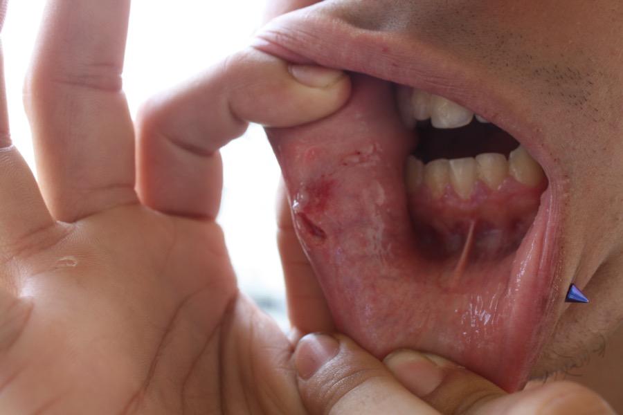 Estudiante herido por policía